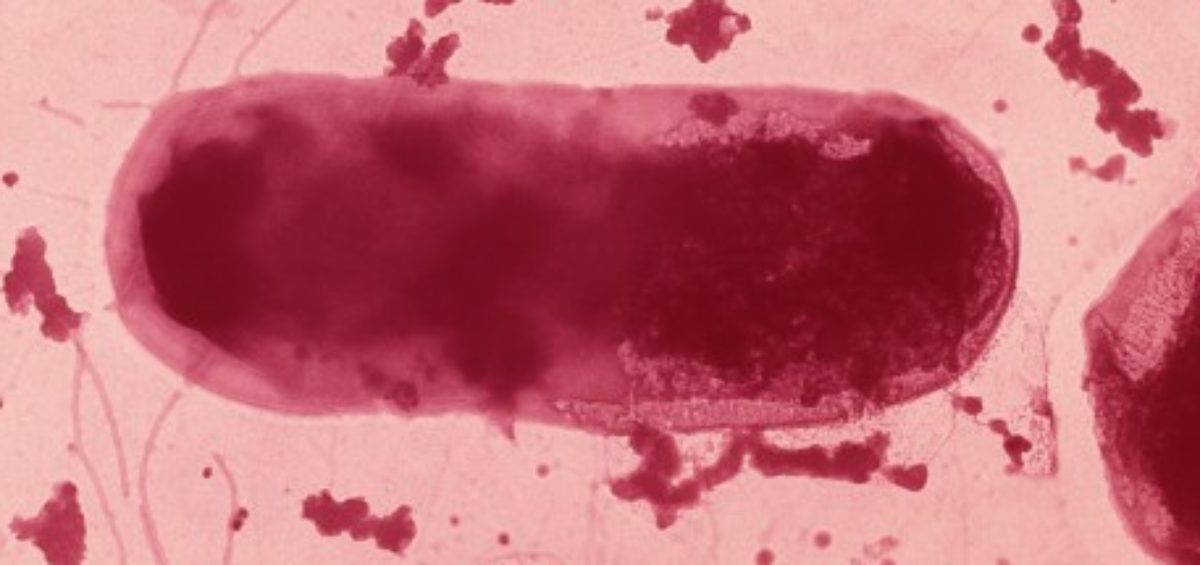 Escherichia Coli, Hôte normal du tube digestif - Inserm