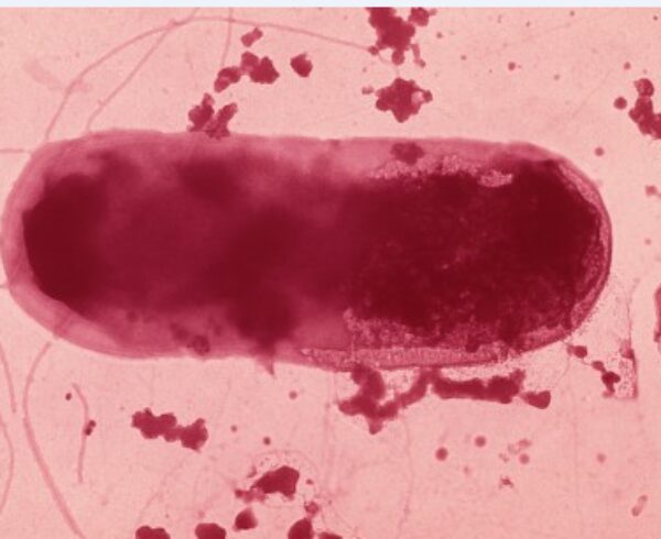 Escherichia Coli, Hôte normal du tube digestif - Inserm